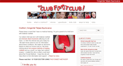 Desktop Screenshot of clubfootclub.org